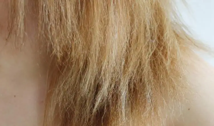 What is elastic, or rubbery, hair and how to treat it