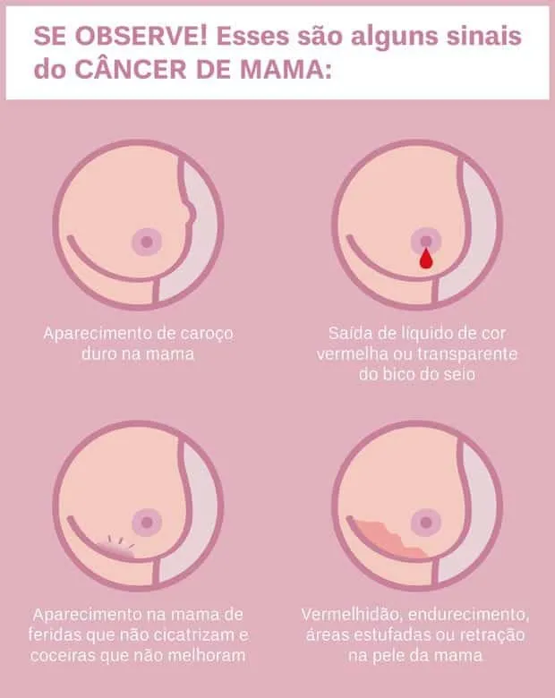 Breast cancer, all about the most common disease among women in the world