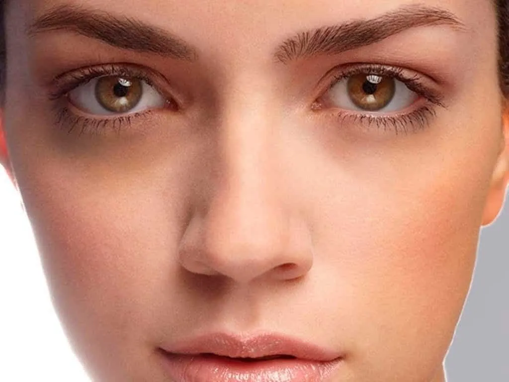 Dark circles: What it is, how to treat and avoid it