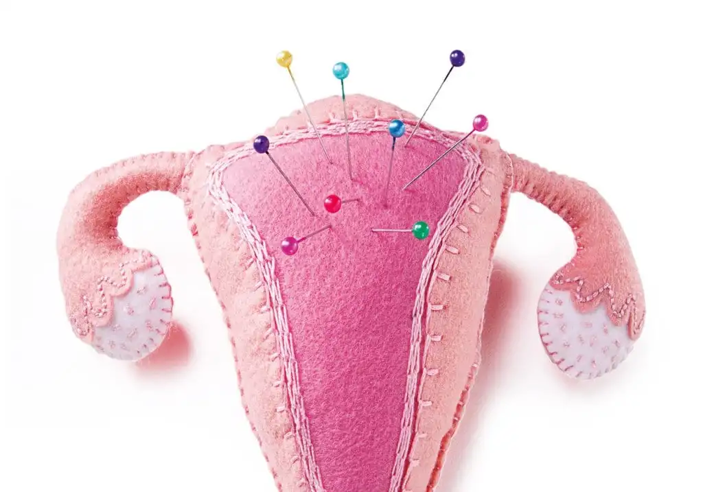 Menstrual cramps - what they are, why they happen and how to relieve them