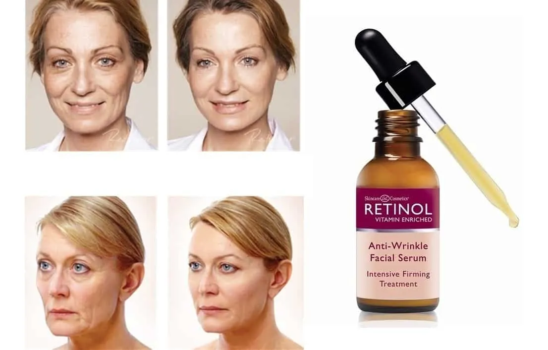 Retinol - what it is, what it is for, how to use it, best products