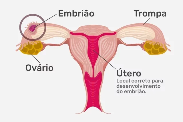 qué es, síntomas, tratamiento y riesgos