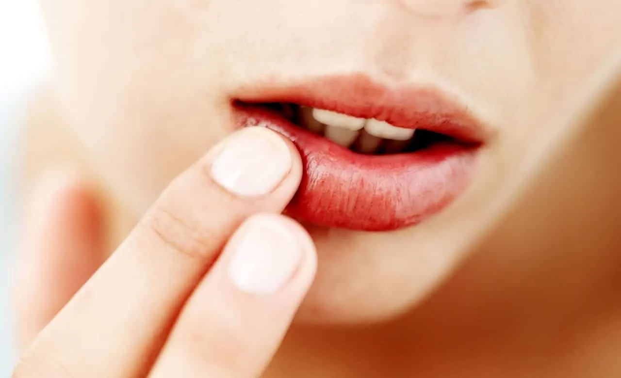 Lips that ressecam, sensitivity, and health of the lips + tips