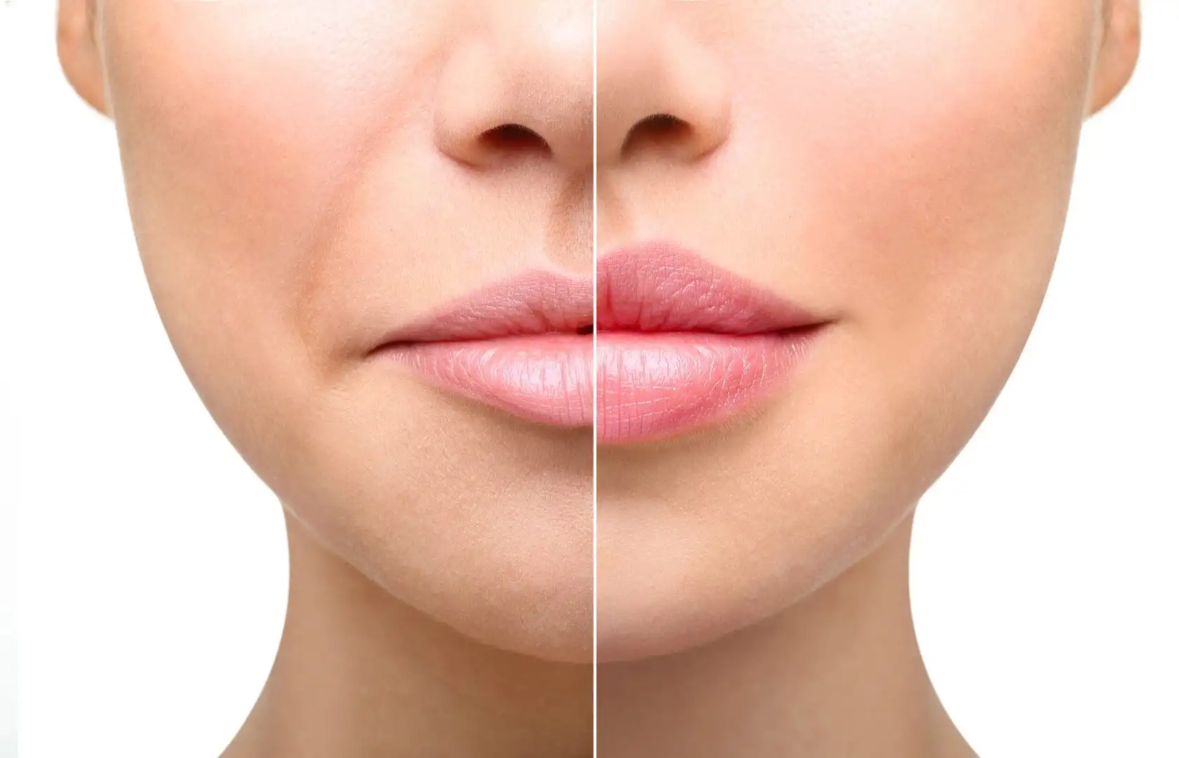 What's your lip filler, how much is a contra-indication