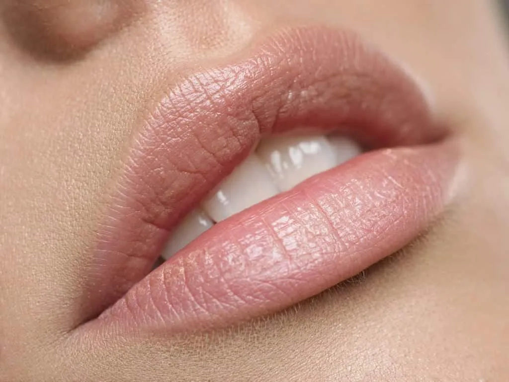 What's your lip filler, how much is a contra-indication