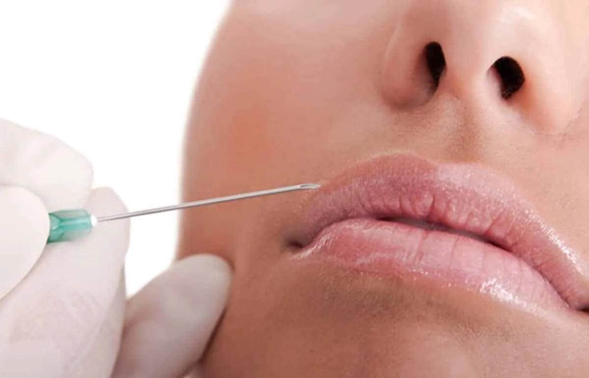 What's your lip filler, how much is a contra-indication