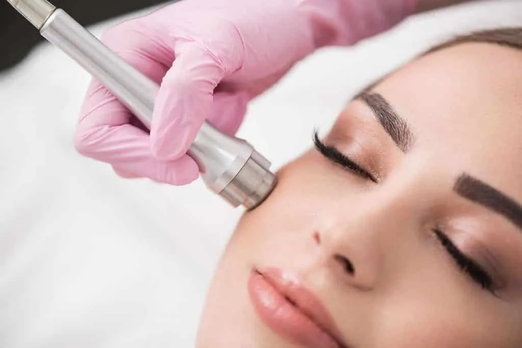 Melasma medicine - find out the best forms of treatment