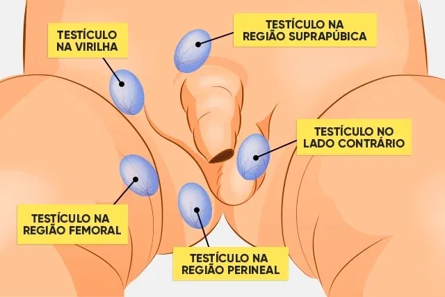 qué es, causas y tratamiento