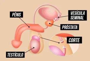 qué es, cómo se hace y otras preguntas habituales