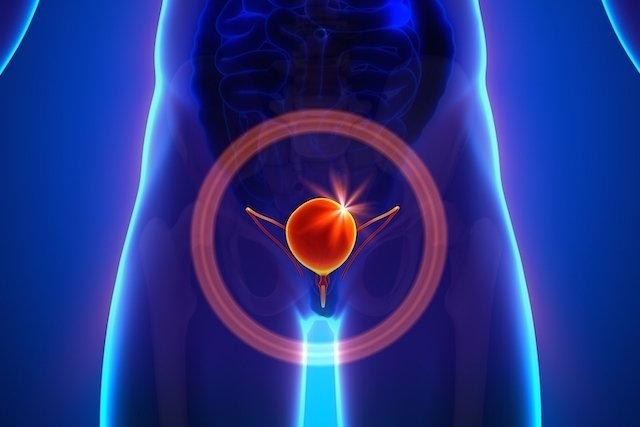 Cystoscopy: what it is, what it is for and how it is done