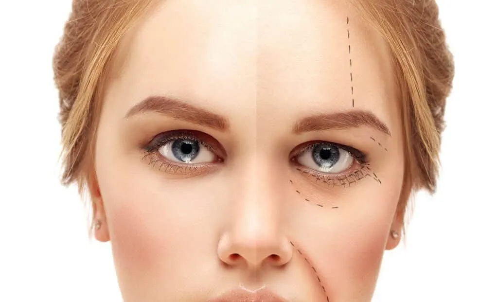 9 Risks of botox: complications that the media doesn't talk about