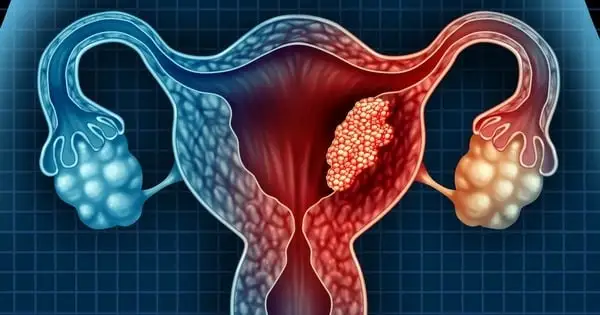 Clot during menstruation: what they are and 7 possible causes