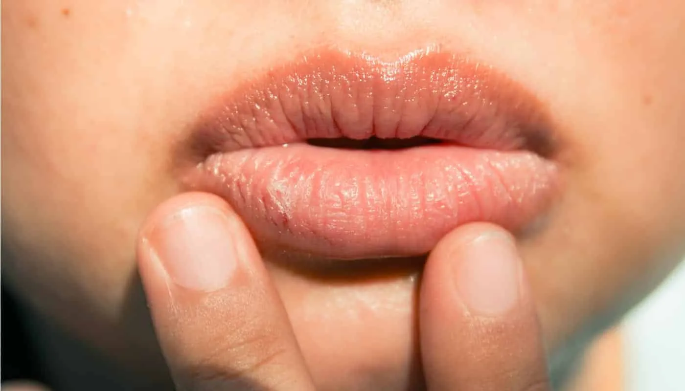 Lips that ressecam, sensitivity, and health of the lips + tips