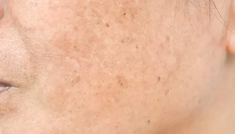 16 things dermatologists want you to know