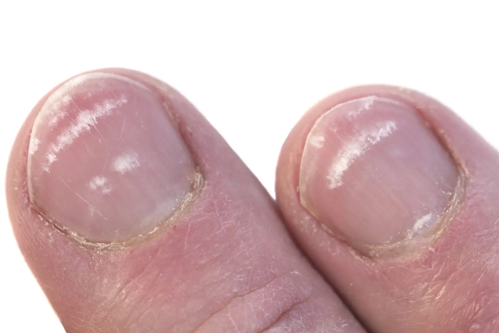 Después de todo, ¿cuál es la diferencia entre el esmalte de uñas en gel y el esmalte de uñas normal?